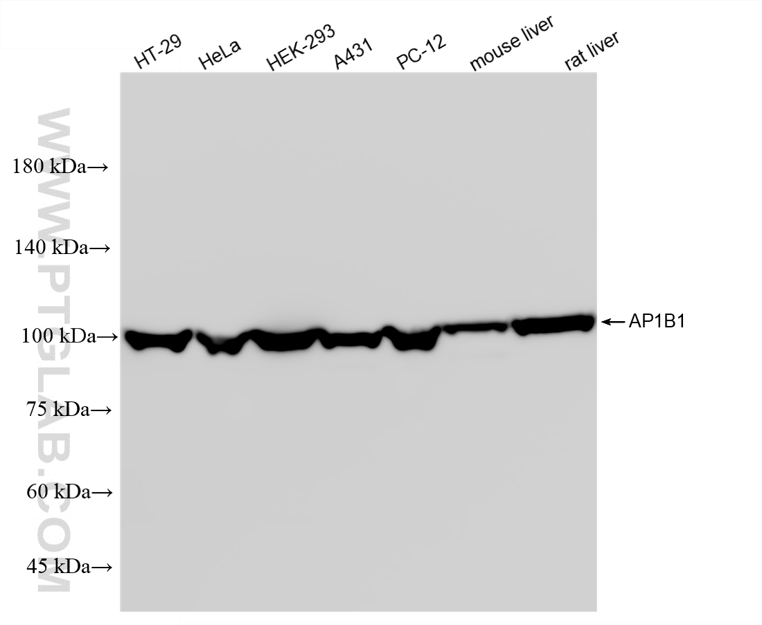 WB analysis using 87859-1-RR (same clone as 87859-1-PBS) WB analysis using 87859-1-RR (same clone as 87859-1-PBS)