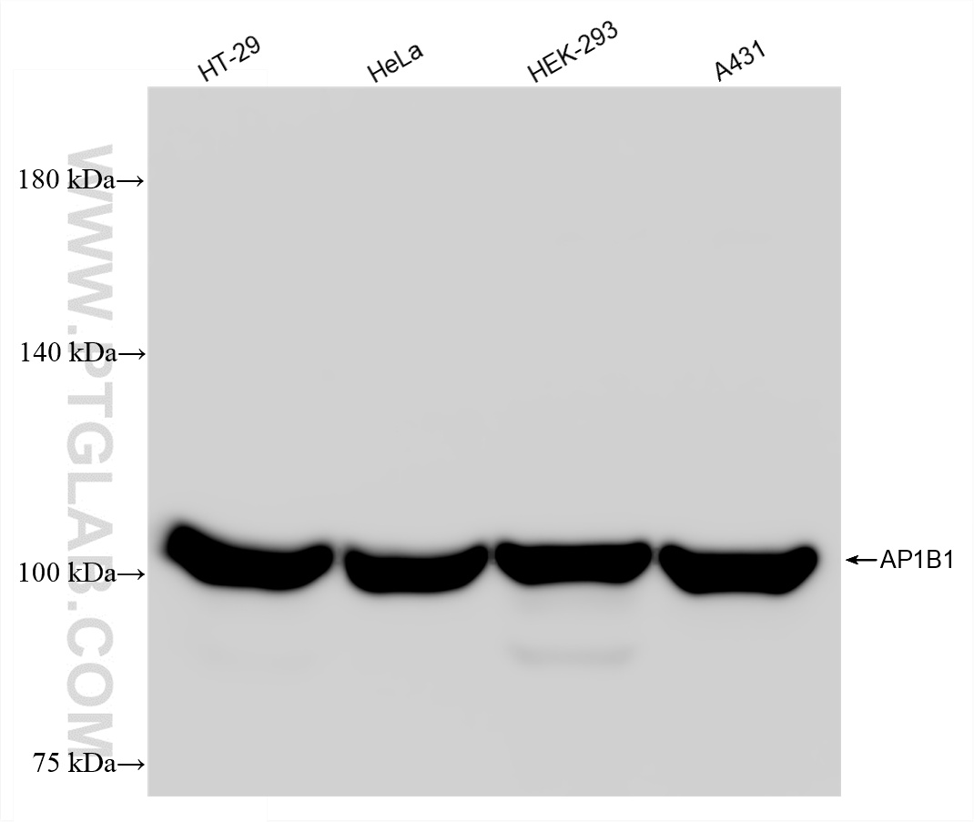 WB analysis using 87859-2-RR (same clone as 87859-2-PBS)