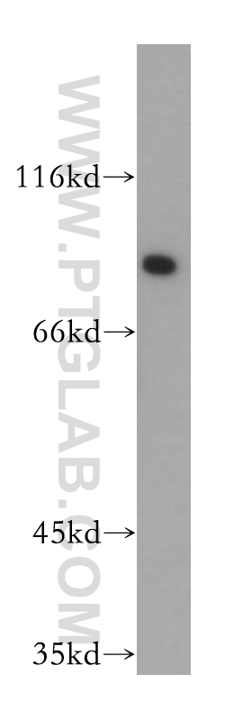 Gamma Adaptin Polyclonal antibody