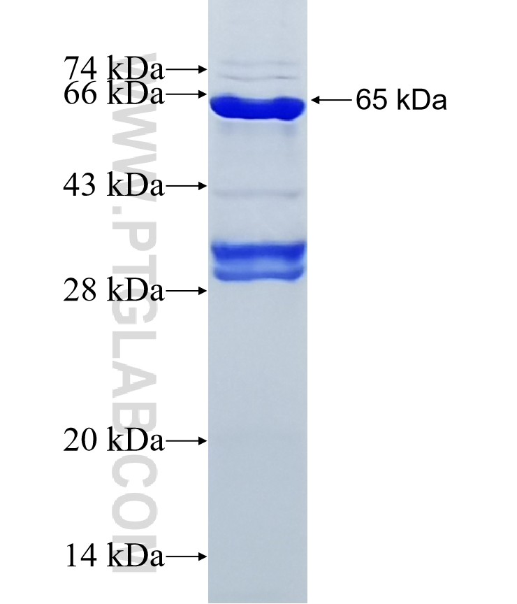 AP1G2 fusion protein Ag11943 SDS-PAGE AP1G2 fusion protein Ag11943 SDS-PAGE