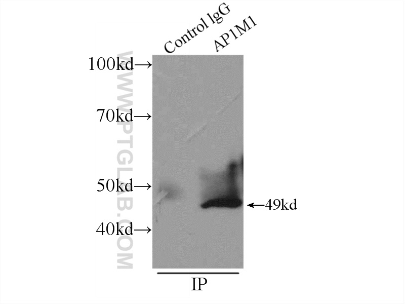 IP experiment of SH-SY5Y using 12112-1-AP