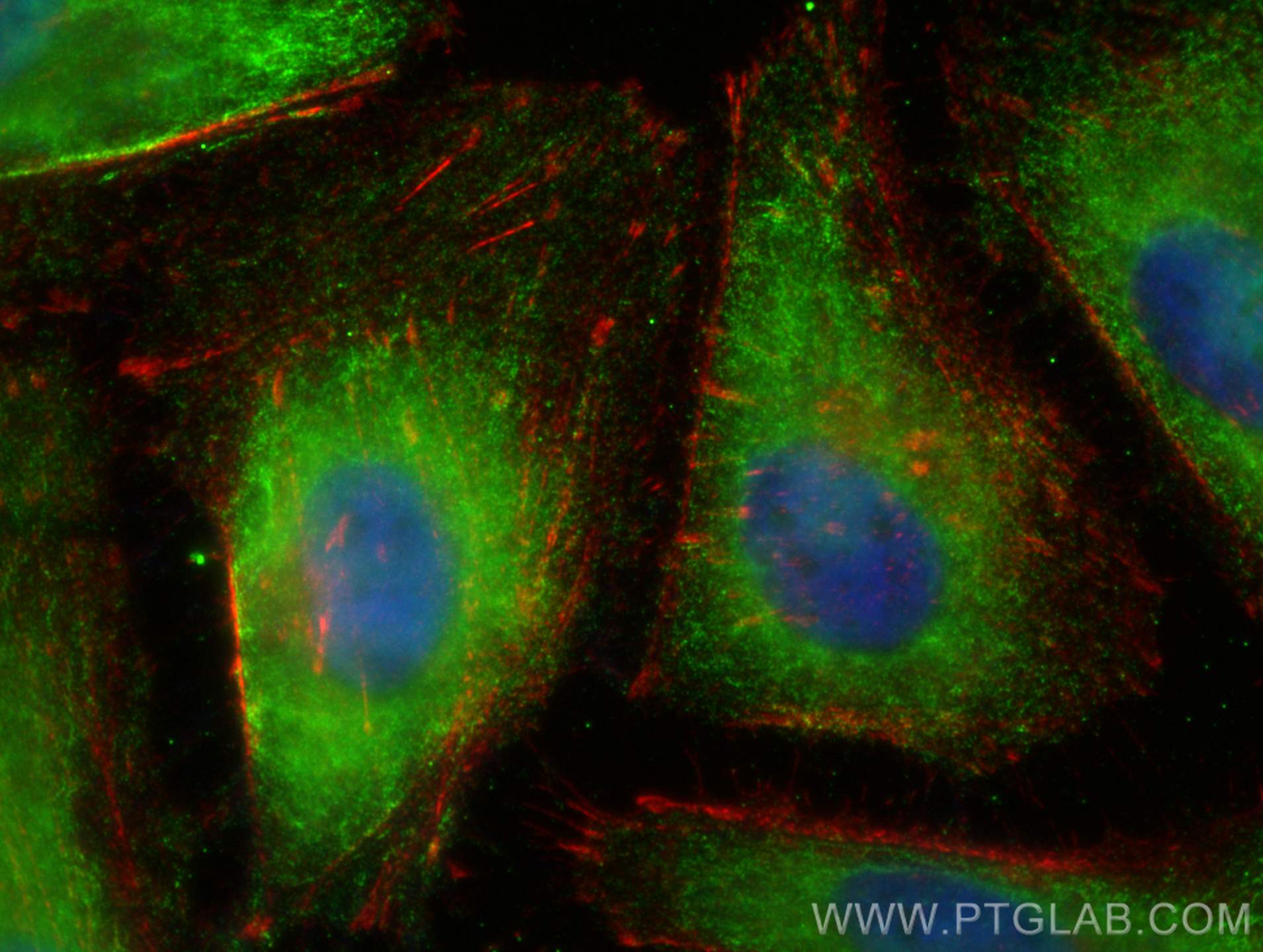 IF Staining of HeLa using 68726-1-Ig