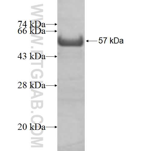 AP1M1 fusion protein Ag2757 SDS-PAGE