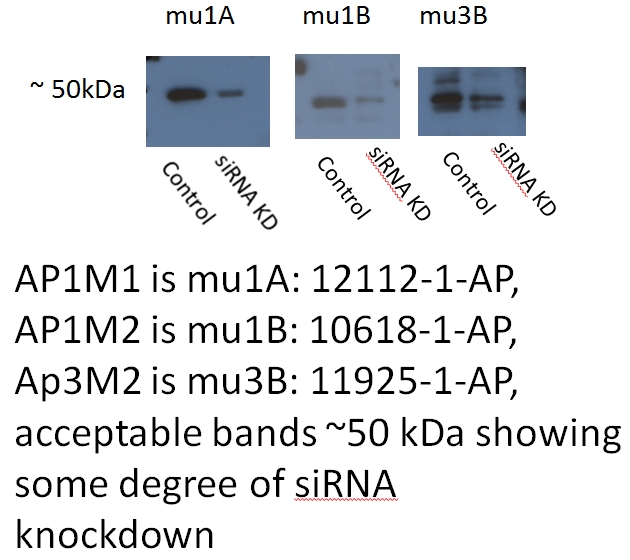 AP1M2 Polyclonal antibody