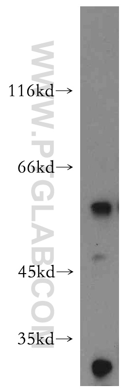 WB analysis of mouse colon using 10618-1-AP