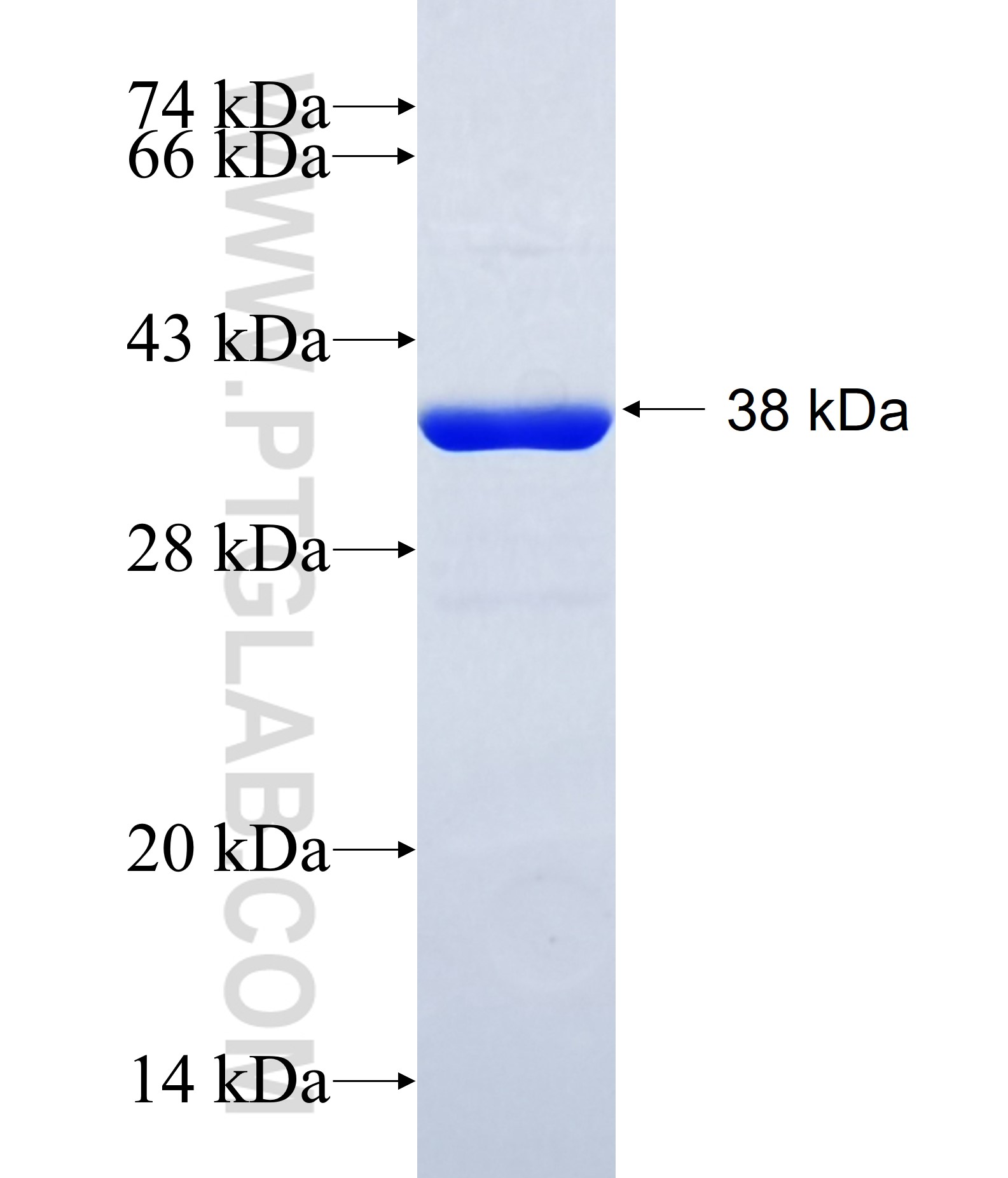 AP1S1 fusion protein Ag34751 SDS-PAGE