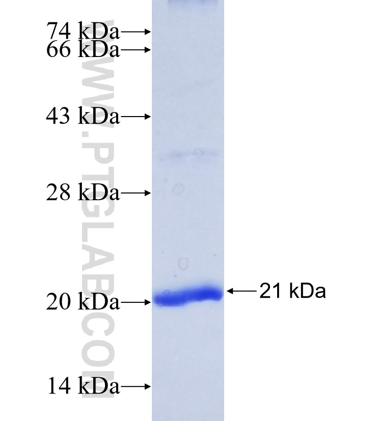 AP1S1 fusion protein Ag34776 SDS-PAGE AP1S1 fusion protein Ag34776 SDS-PAGE