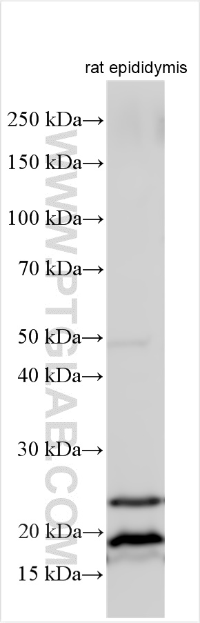 WB analysis using 15043-1-AP