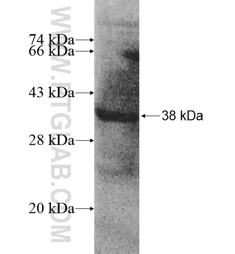 AP1S3 fusion protein Ag10777 SDS-PAGE AP1S3 fusion protein Ag10777 SDS-PAGE