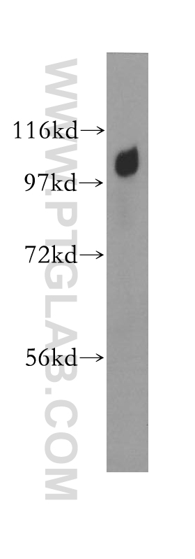 WB analysis of HEK-293 using 11401-1-AP