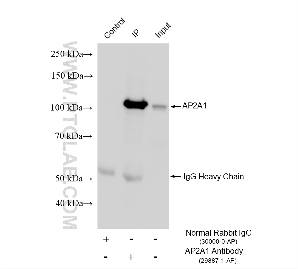 IP experiment of HEK-293 using 29887-1-AP IP experiment of HEK-293 using 29887-1-AP