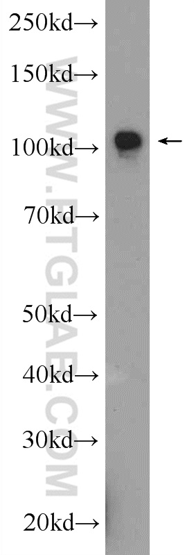 AP2A2 Polyclonal antibody