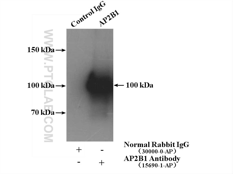 IP experiment of K-562 using 15690-1-AP