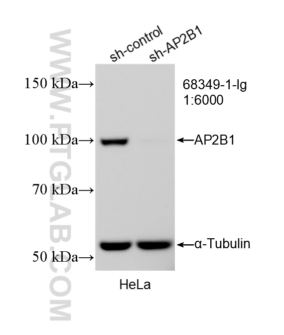 WB analysis of HeLa using 68349-1-Ig