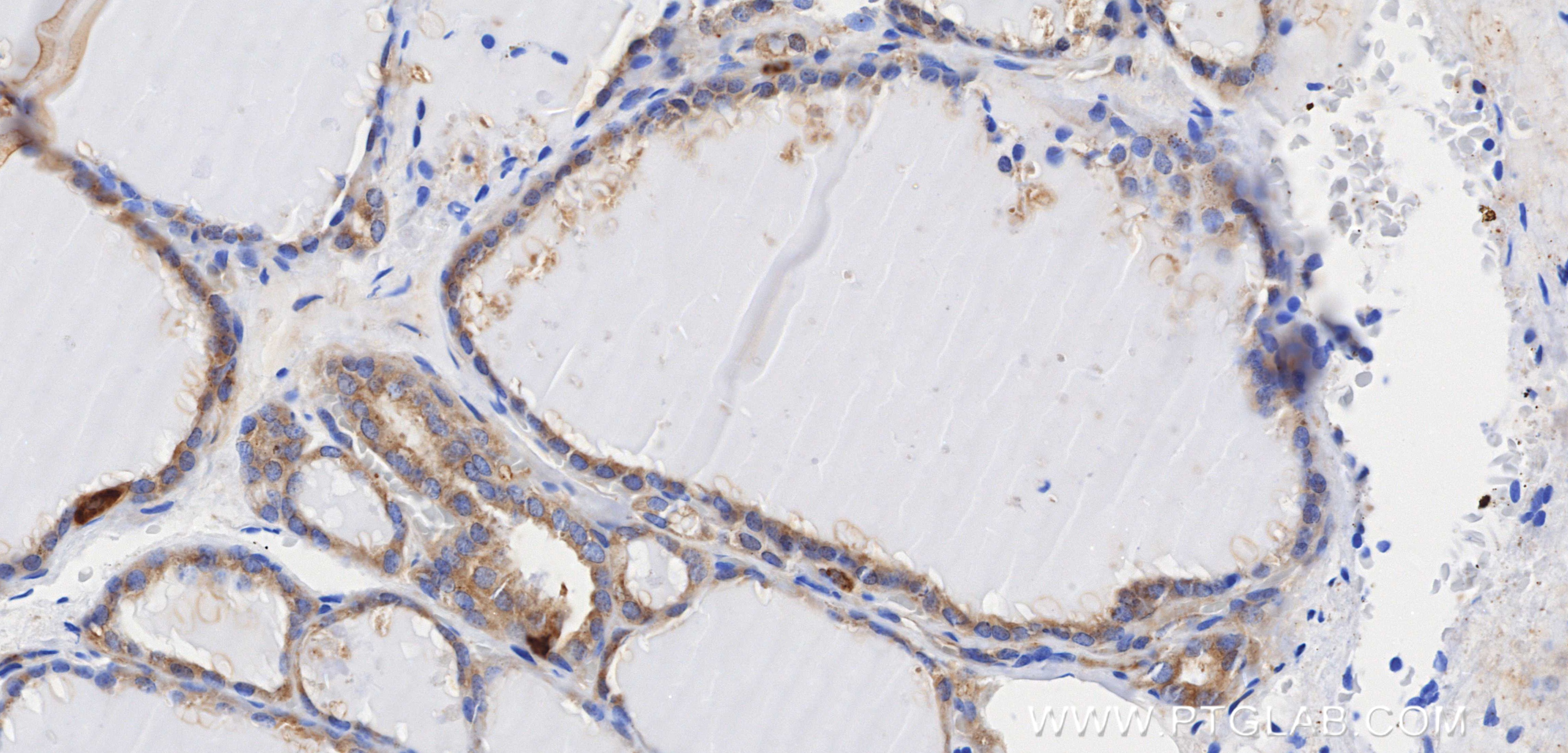 IHC staining of human thyroid using 84174-3-RR