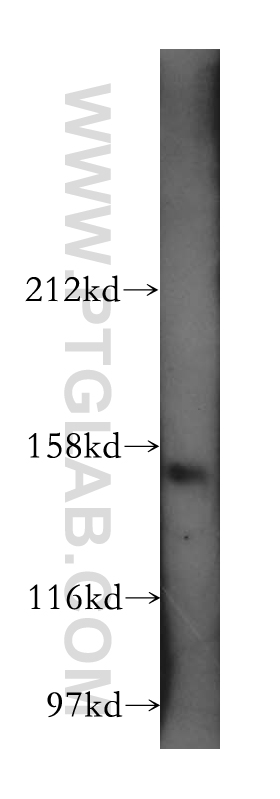 AP3B1 Polyclonal antibody