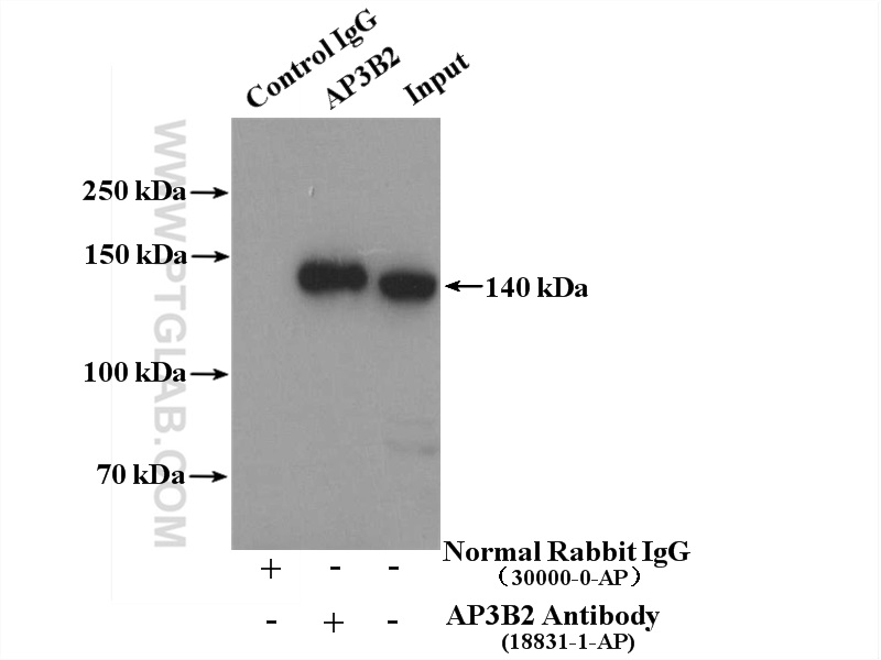 IP experiment of mouse brain using 18331-1-AP