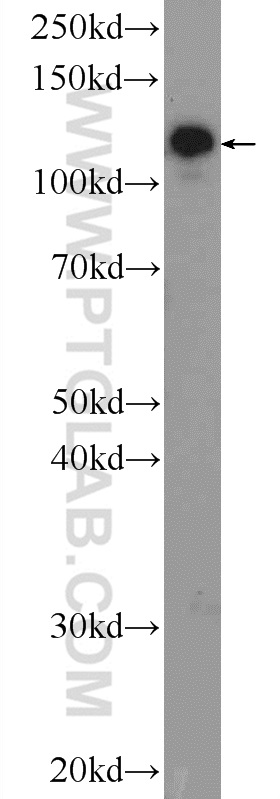 AP3B2 Polyclonal antibody