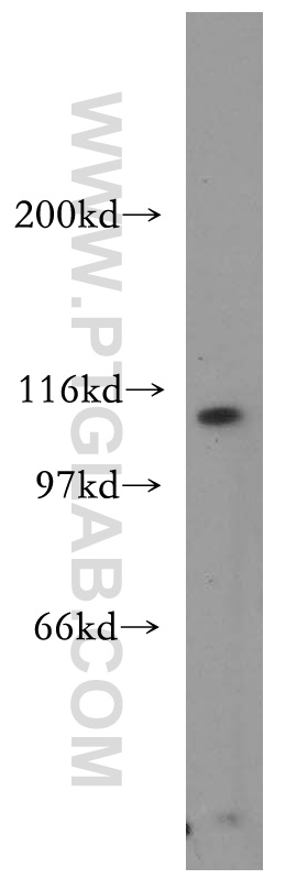 AP3D1 Polyclonal antibody
