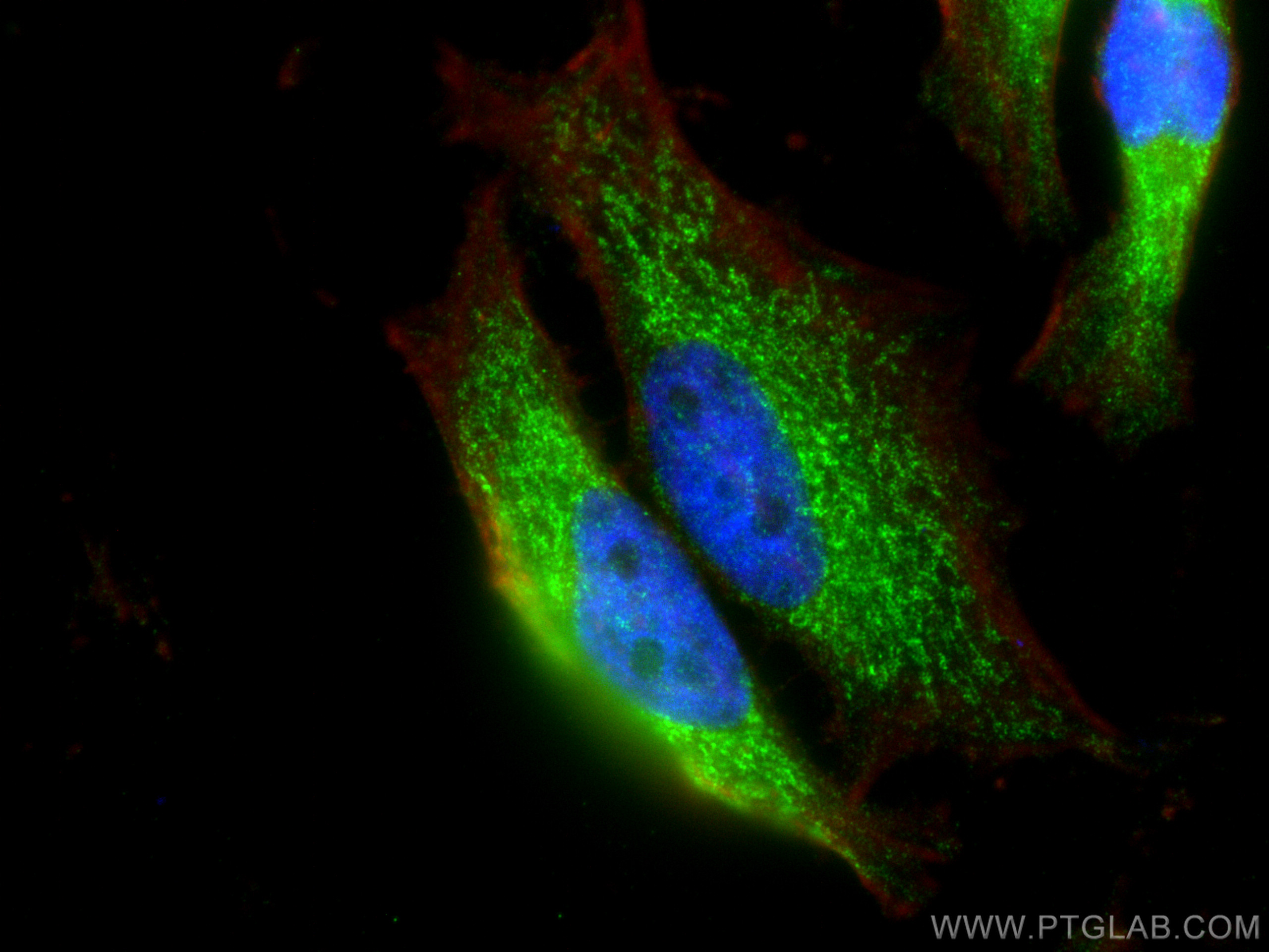 IF Staining of HeLa using 12114-1-AP