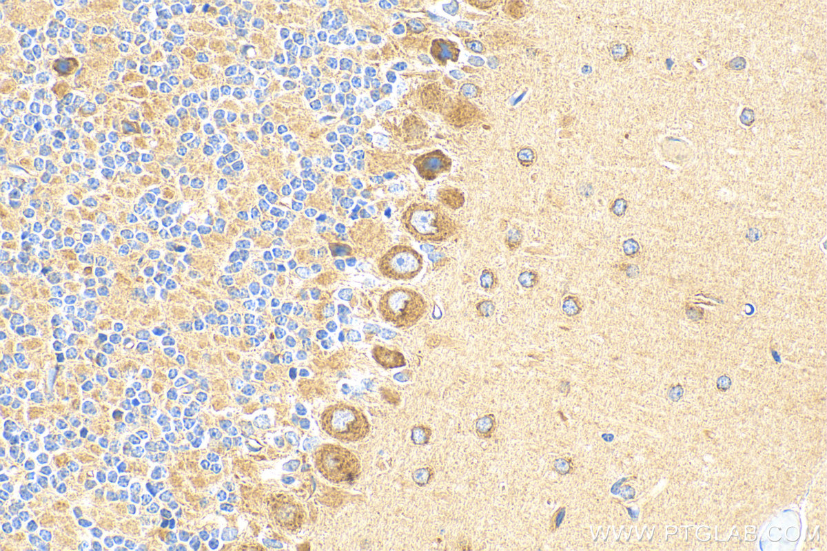 IHC staining of mouse cerebellum using 12114-1-AP