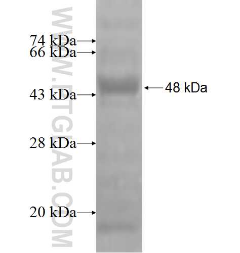 AP3M1 fusion protein Ag2759 SDS-PAGE