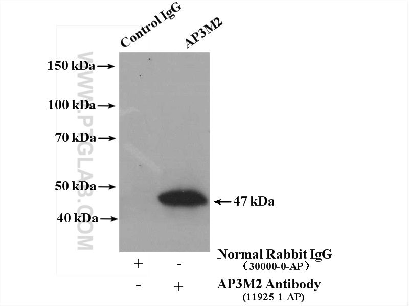 IP experiment of mouse brain using 11925-1-AP