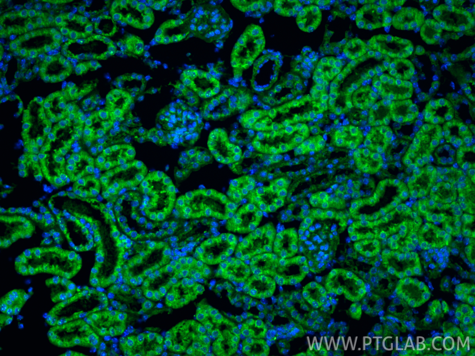 IF Staining of mouse kidney using 32945-1-AP