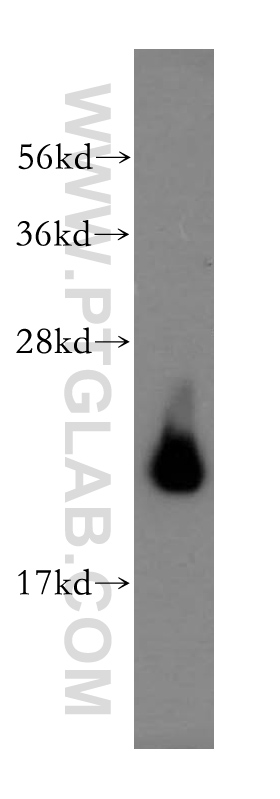 AP3S2 Polyclonal antibody