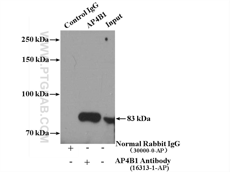 IP experiment of HeLa using 16313-1-AP