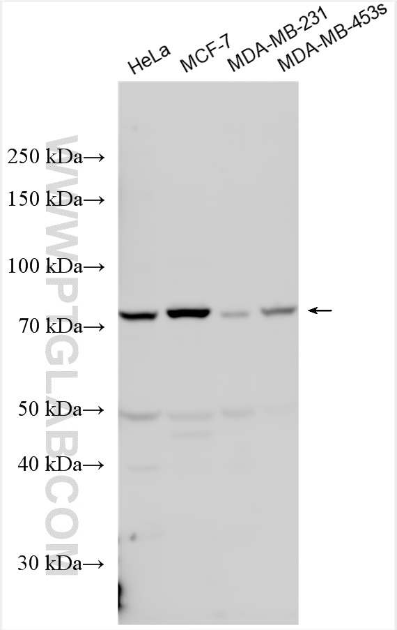 WB analysis using 16313-1-AP