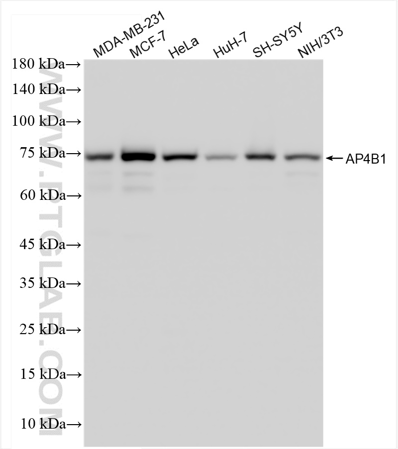 WB analysis using 84710-3-RR (same clone as 84710-3-PBS)