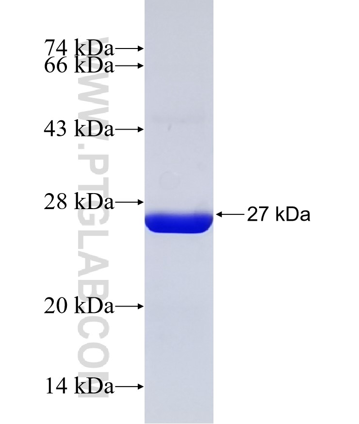 AP4M1 fusion protein Ag32292 SDS-PAGE AP4M1 fusion protein Ag32292 SDS-PAGE