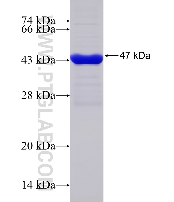 AP4M1 fusion protein Ag32301 SDS-PAGE