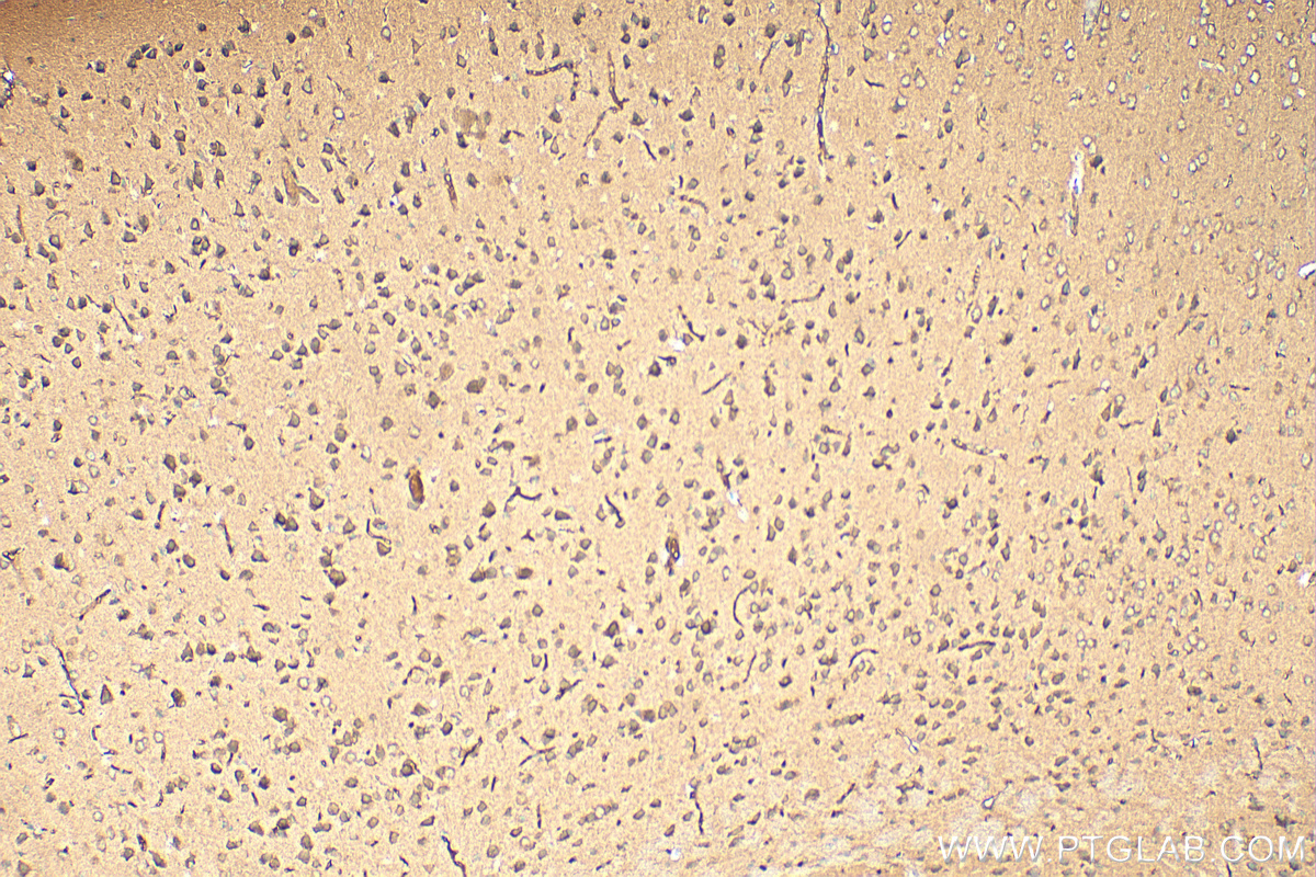 IHC staining of mouse brain using 27202-1-AP