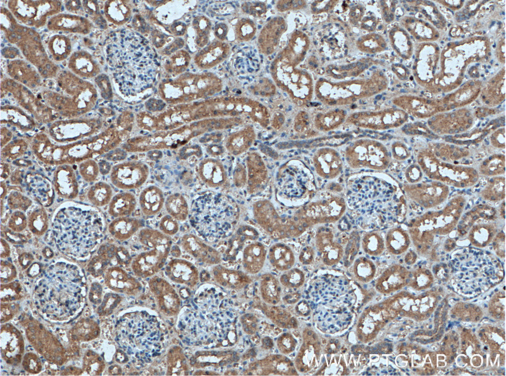 IHC staining of human kidney using 27355-1-AP