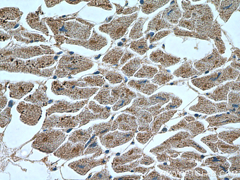 IHC staining of human heart using 21710-1-AP