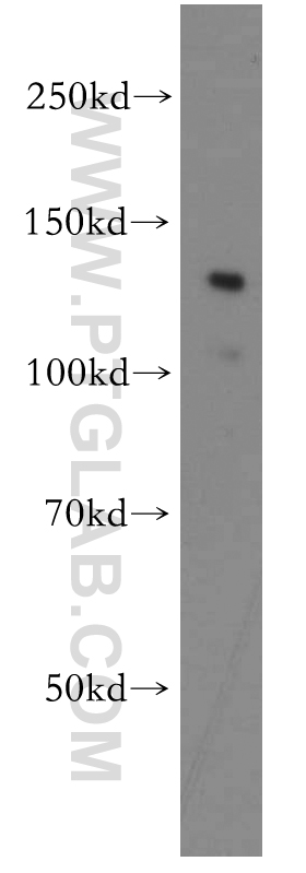 WB analysis of HEK-293 using 21710-1-AP