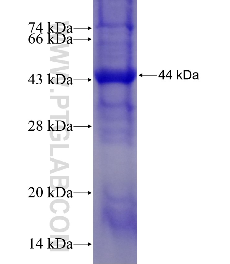 APAF1 fusion protein Ag17992 SDS-PAGE APAF1 fusion protein Ag17992 SDS-PAGE