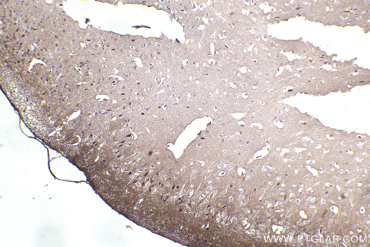 IHC staining of mouse brain using 55089-1-AP