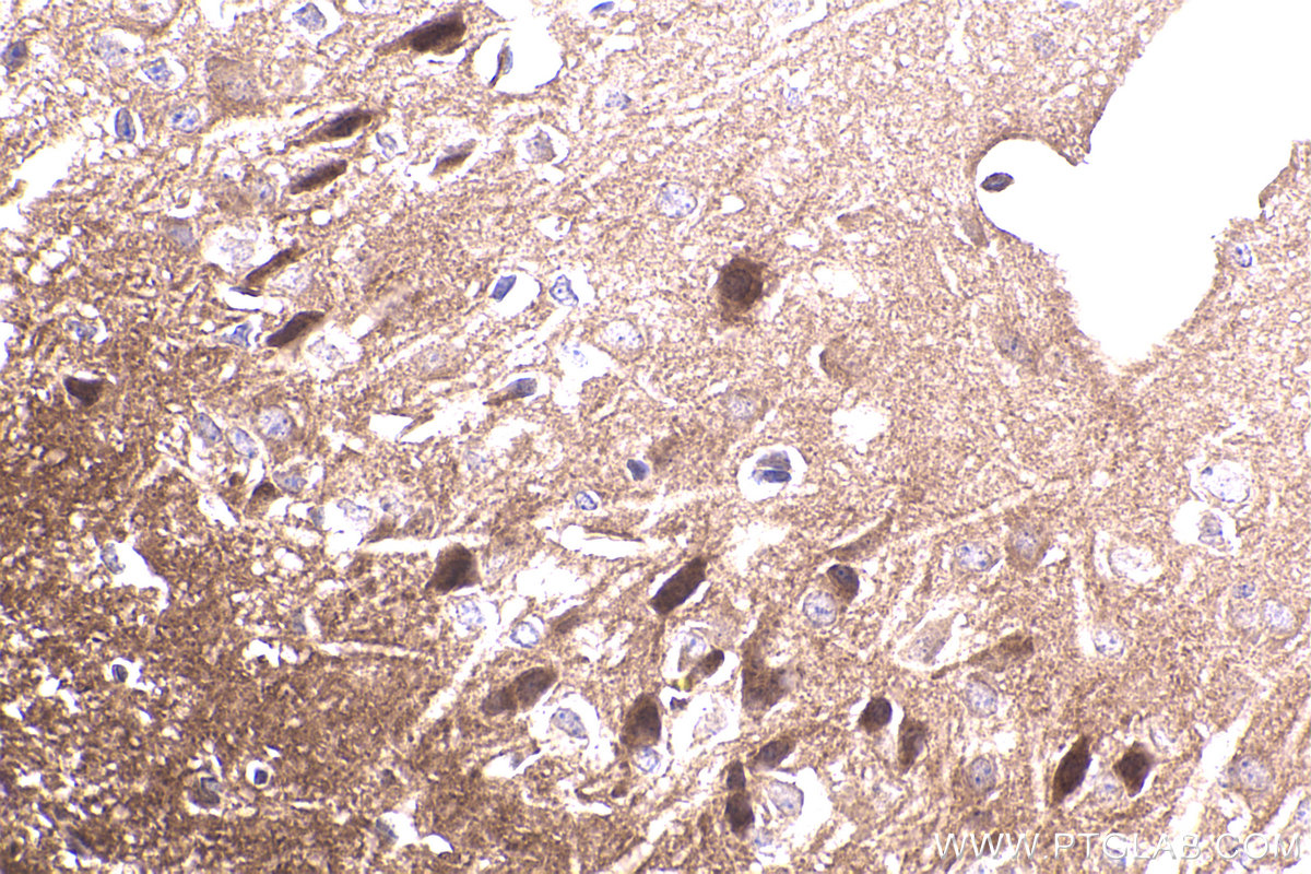 IHC staining of mouse brain using 55089-1-AP