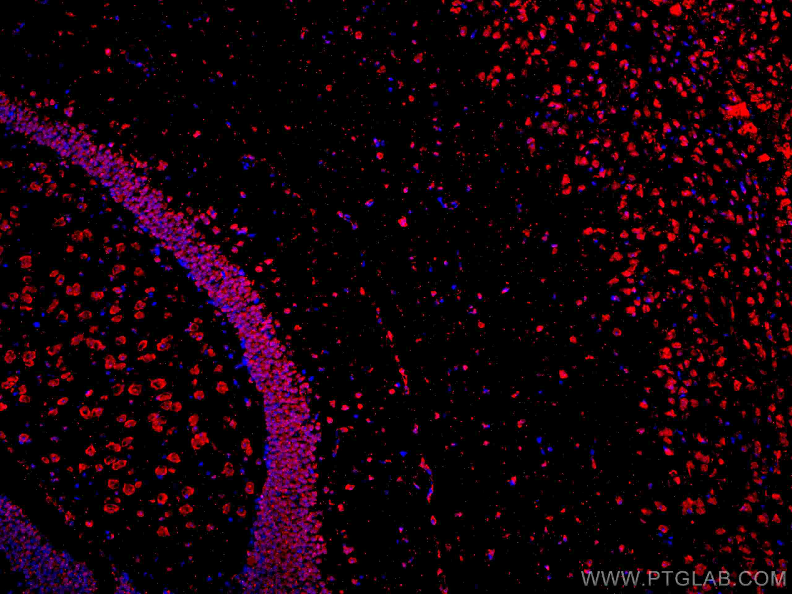 IF Staining of mouse brain using CL594-67077