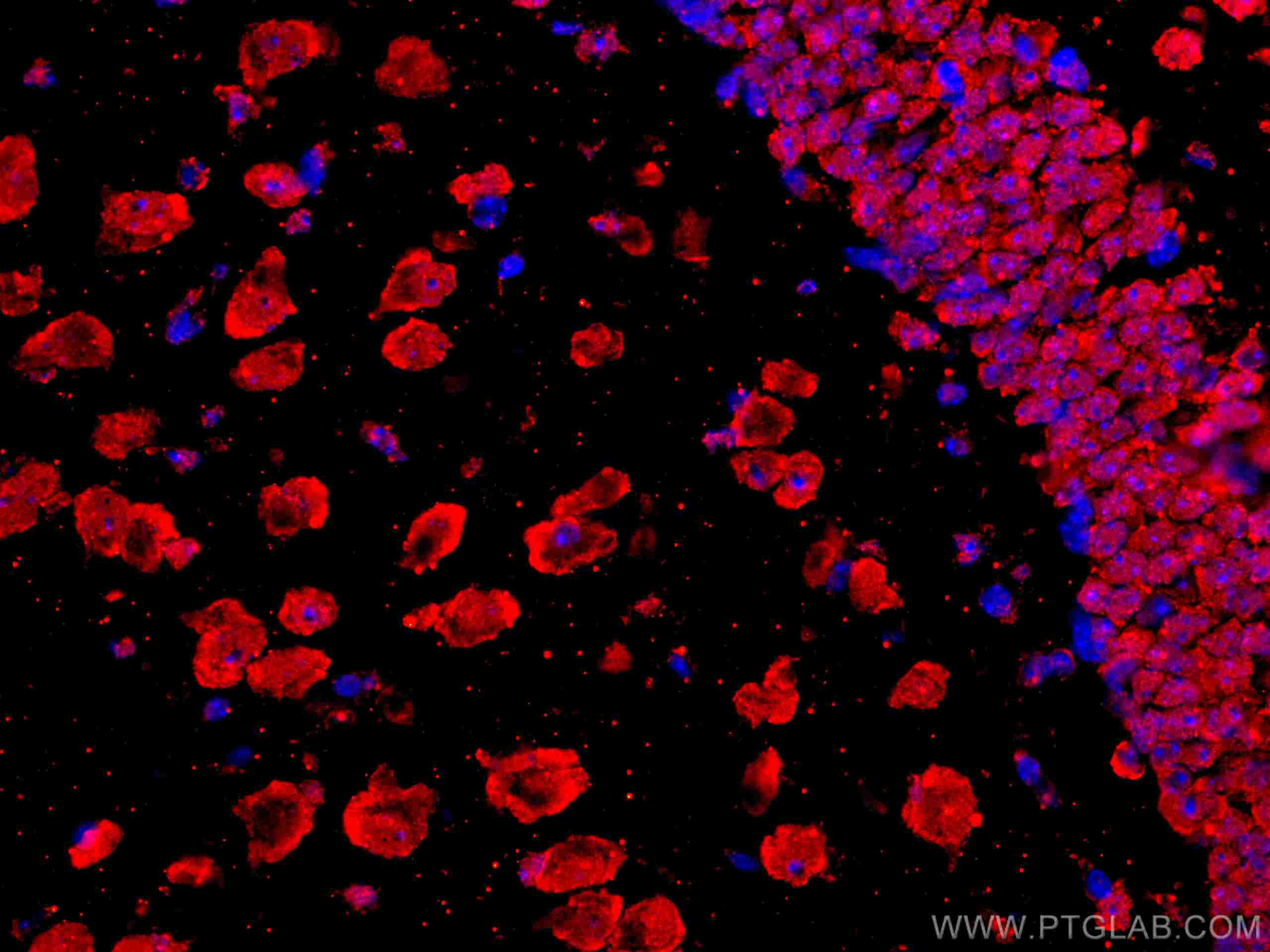 IF Staining of mouse brain using CL594-67077