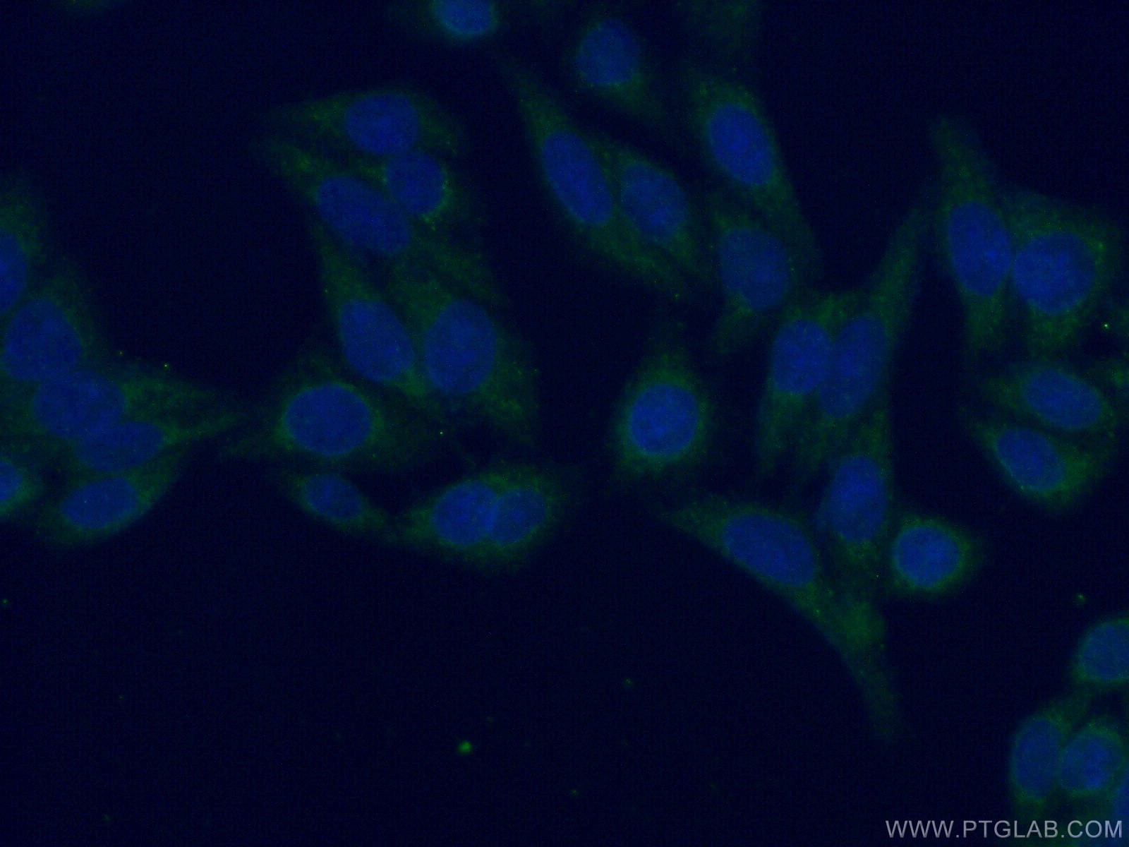 IF Staining of HeLa using 13177-1-AP