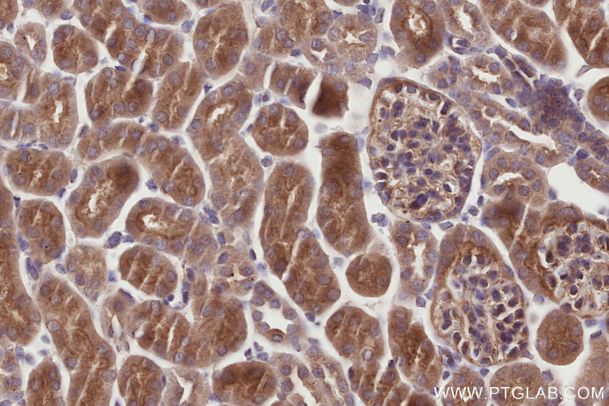 IHC staining of mouse kidney using 13177-1-AP