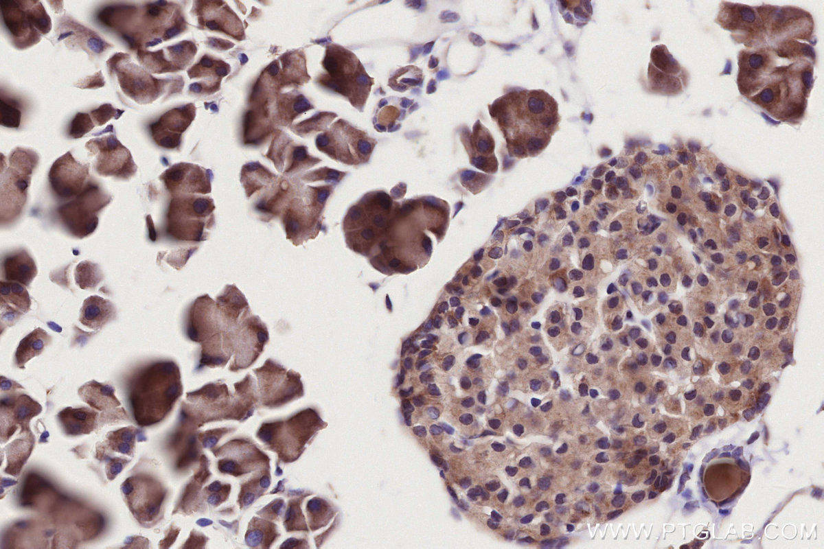 IHC staining of mouse pancreas using 13177-1-AP