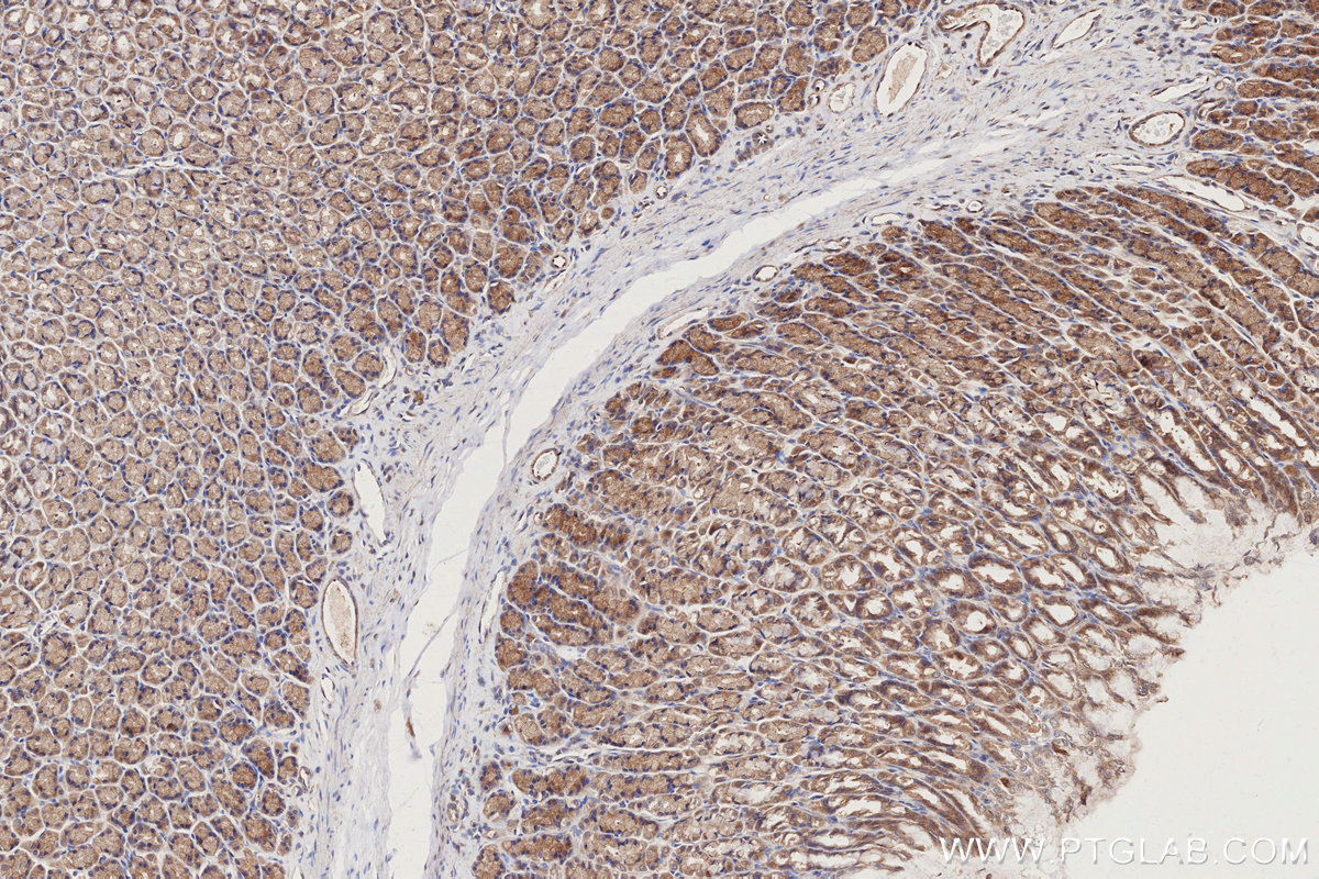 IHC staining of rat stomach using 13177-1-AP IHC staining of rat stomach using 13177-1-AP