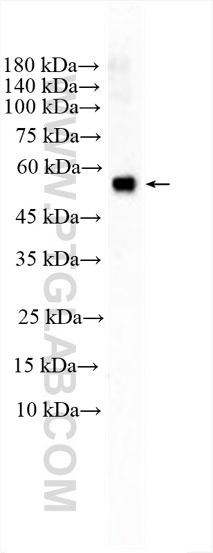 WB analysis of human plasma using 12051-1-AP