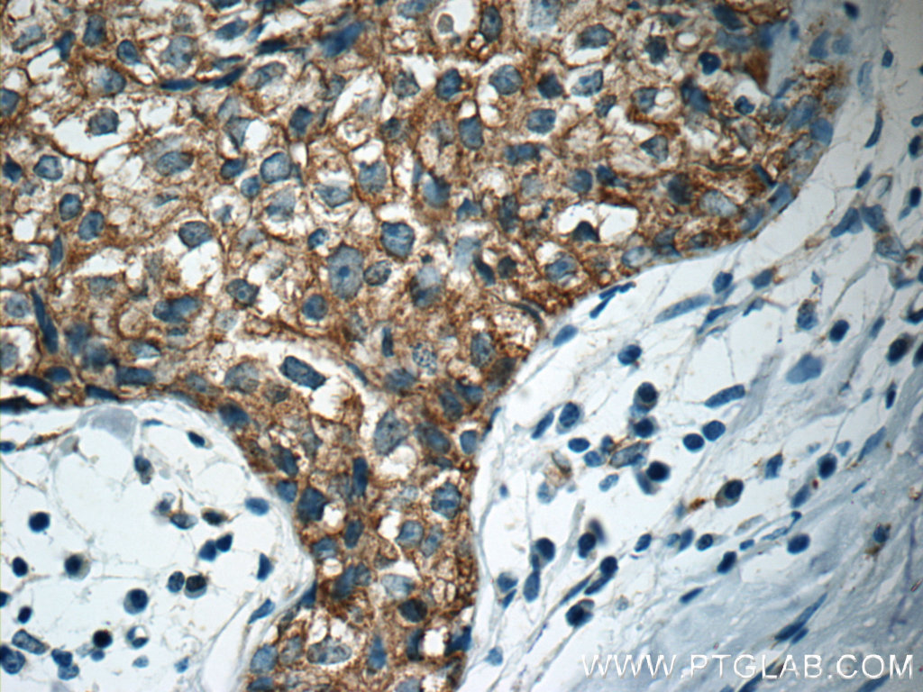 APC Polyclonal antibody