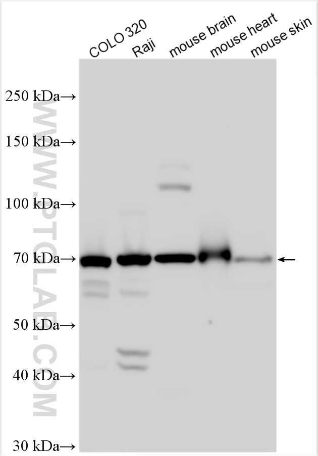 WB analysis using 17024-1-AP